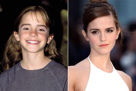 Hermione Granger Then And Now