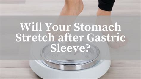 Will Your Stomach Stretch After Gastric Sleeve Surgery