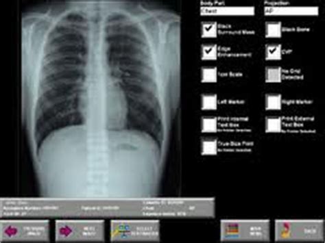 The Benefits of Computed Radiography (CR)