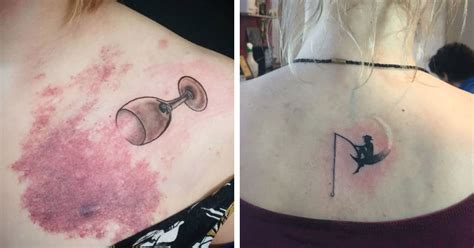 20 Incredible Tattoos That Cover Birthmarks And Scars Inner Strength Zone