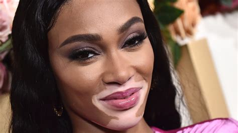 Inside Winnie Harlow And Kyle Kuzmas Relationship