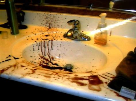 A Sink That Has Some Brown Stuff On The Counter Top And It Is Full Of Blood