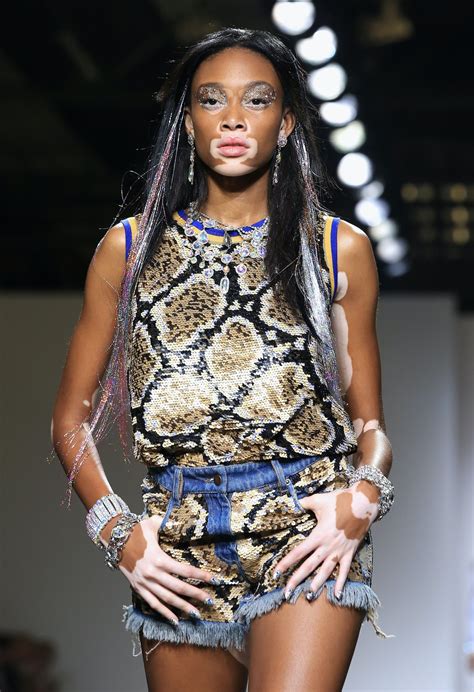 winnie harlow stars in diesel s new campaign and the former america s next top model is proving