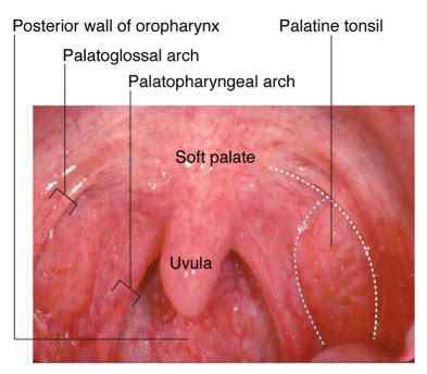 Of course, it always starts right before the weekend. Differential Diagnosis of Sore Throat