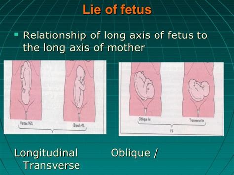 Definitions In Obs Lect