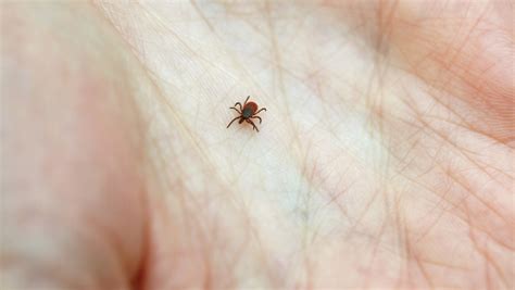 don t panic if you get bit by a tick here are 5 tips to minimize lyme mpr news