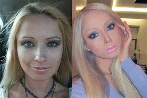 Real Life Barbie Plastic Surgery Before And After Real Life Barbie Plastic Surgery Before And