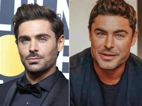 Whats Behind Zac Efrons New Cheeks And Jawline According To Experts