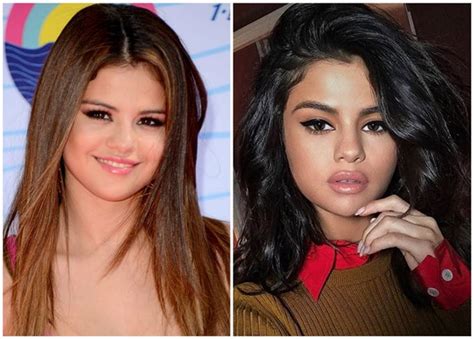 juicy facts about the selena gomez s plastic surgery claims japan media review