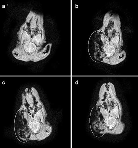 Mri T2 Weighted Images Trte Of 2348 Ms46 Ms At A Pre Injection