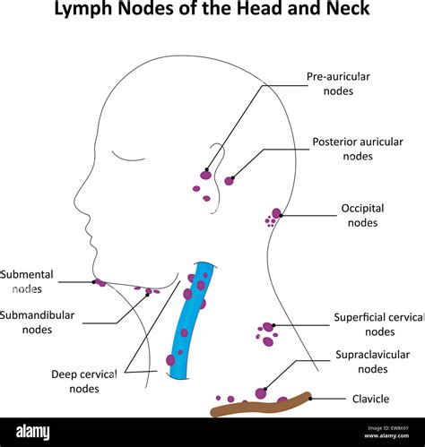 Map Of Head And Neck Lymph Nodes