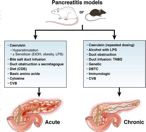 Acute Pancreatitis Pathway