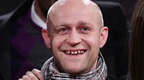 Jürgen Vogel über seine Zähne - Darum sehen sie so aus