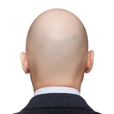 150 Completely Bald Shaved Head Human Head Rear View Stock Photos
