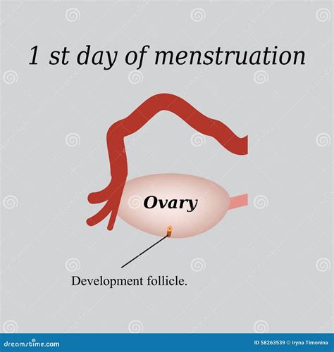O Primeiro Dia Da Menstruação O Desenvolvimento De Ilustração Do Vetor Ilustração De
