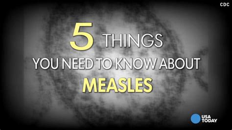 Measles 5 Things You Need To Know