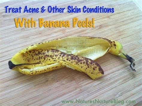 Banana Peel Skin Care How To Treat Acne Health And Beauty Tips