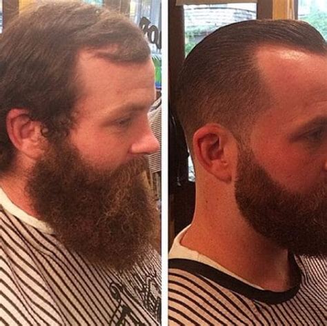Mens Fade Haircut With Receding Hairline