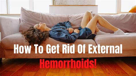 how to get rid of external hemorrhoids youtube