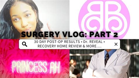 Surgery Vlog Part 2 30 Day Post Op Results Surgeon Reveal Recovery