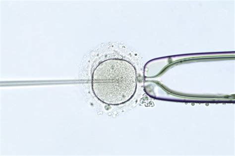 Ins Mination Artificielle Par L Injection Intracytoplasmique De Sperme Image Stock Image Du