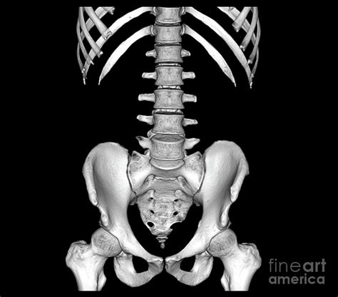 Healthy Spine And Pelvis Photograph By Zephyrscience Photo Library