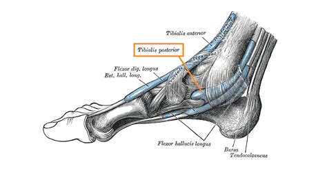 Posterior Tibial Tendon Tear Ankle