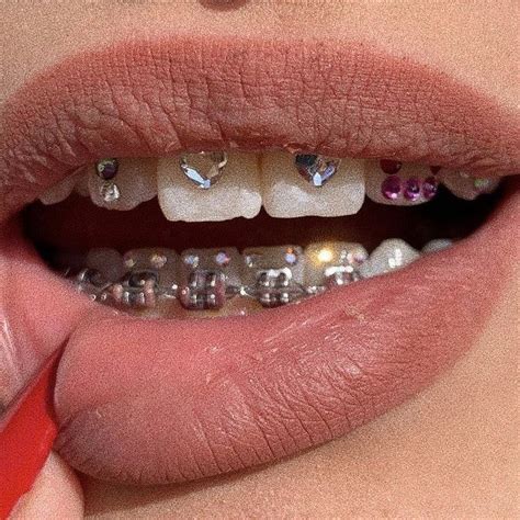 DIY Tooth Gem Kits On Instagram Tooth Jewelry Is Even Possible When You Have Braces You