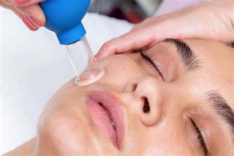 facial cupping what is it and what does it achieve la longevity