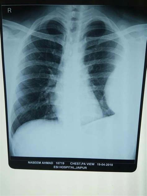 Posted on may 30, 2021july 21, 2021 by christopher radiology describes a form of medicine where imaging scans are used by doctors and other medical. 2 types of mesothelioma #Mesothelioma | Mesothelioma ...