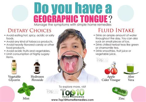 Geographic Tongue Home Remedies Geographic Tongue Home Remedies