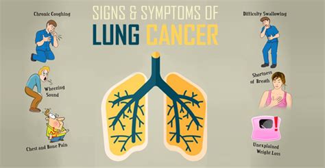 The Symptoms Of Lung Cancer In Males And Females