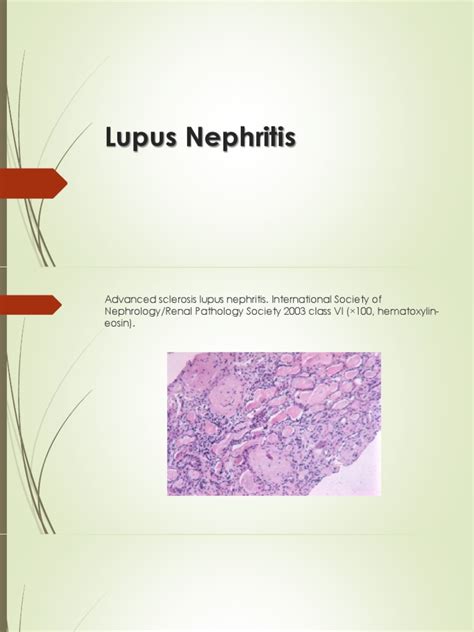 Lupus Nephritispptx Systemic Lupus Erythematosus Earth And Life Sciences