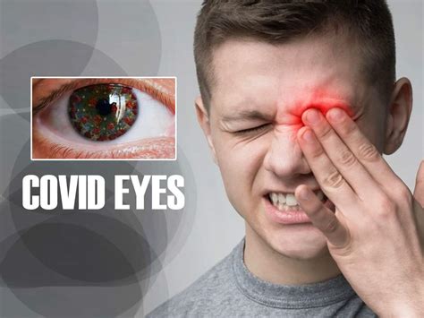 Covid Eyes Sore Eyes And Other Symptoms Your Eyes May Show After
