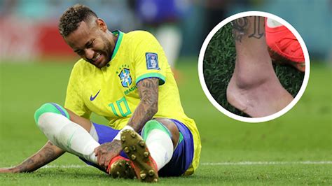 Neymar Pictured With Swollen Ankle In Huge World Cup Injury Scare For