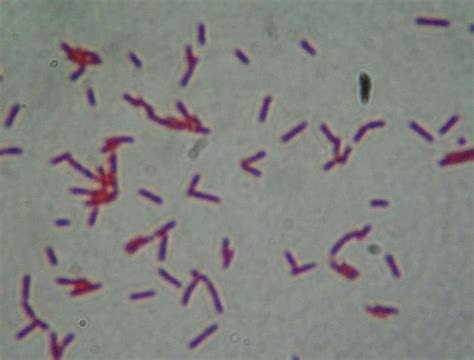 Endospore Stains Of Bacillus Thuringiensis A Di 29 B C 18