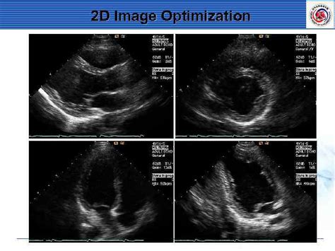 Standard Imaging Of Transthoracic Echocardiography Terminology A