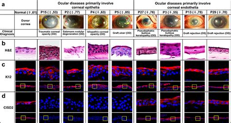 Cisd Plays An Essential Role In Corneal Epithelial Regeneration