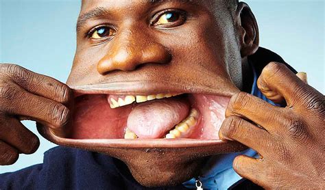 Widest Mouth World Record Set By Francisco Domingo Joaquim