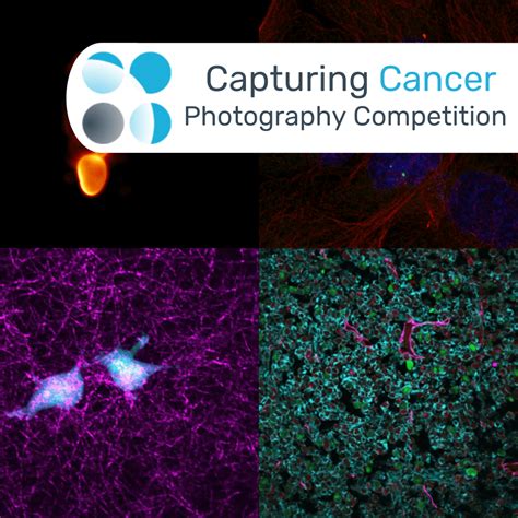 Capturing Cancer Oncology Central Photography Competition Winners