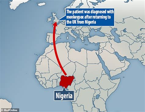 Monkeypox is a rare viral infection that does not spread easily between people and the risk to the general public in england is very low. NHS hospital confirms patient has monkeypox after catching ...