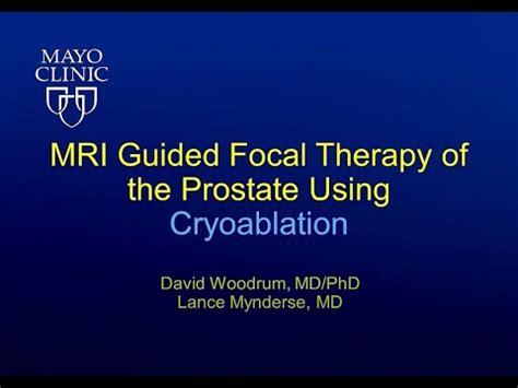 MRI Guided Focal Therapy Of The Prostate Using Cryoablation YouTube