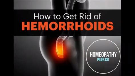 complete hemorrhoids treatment with doctor recommended homeopathic kit youtube