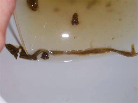 This Is Not A Roundworm At Parasites Support Forum Alt Med