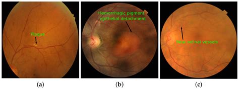 Data Free Full Text Retinal Fundus Multi Disease Image Dataset Rfmid A Dataset For Multi