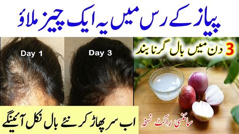 In 3 Days Stop Hair Fall And Get Thicker And Longer Hair Bal Lamby