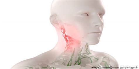 Symptoms Of Lymph Node Cancer Cancer