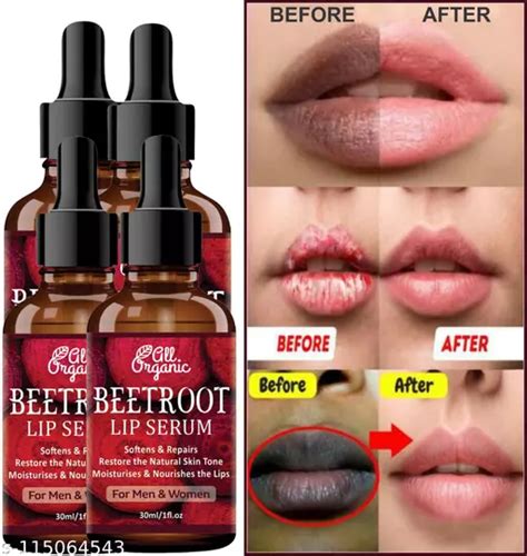 Lip For Beetroot Brightening Pink Lip For Lip Lightening And For Dry Lips