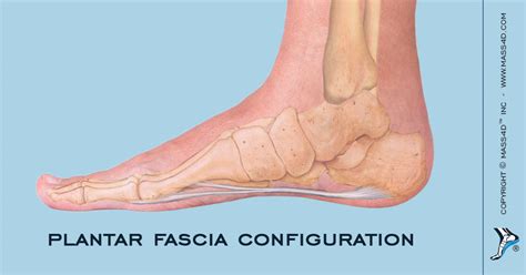 Plantar Fascia Configuration Mass4d® Foot Orthotics