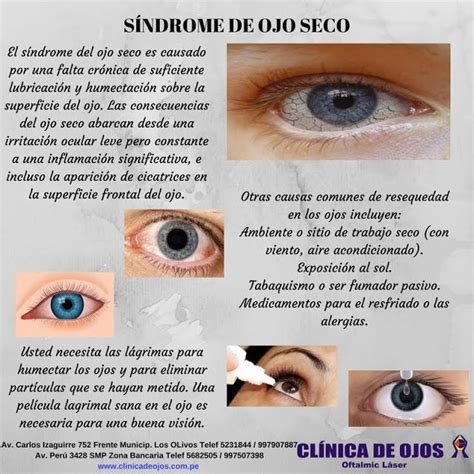 clínica de ojos oftalmic láser sÍndrome de ojo seco sindrome de ojo seco enfermedades de la